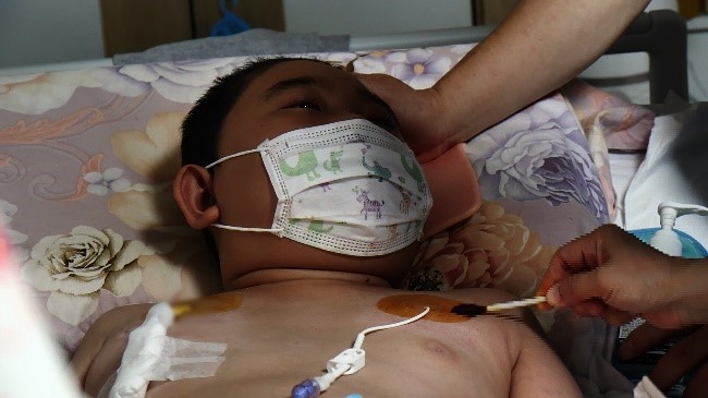 ▲3년 전 발병한 뇌종양으로 투병중인 열다섯 살 최기극 군 (사진제공