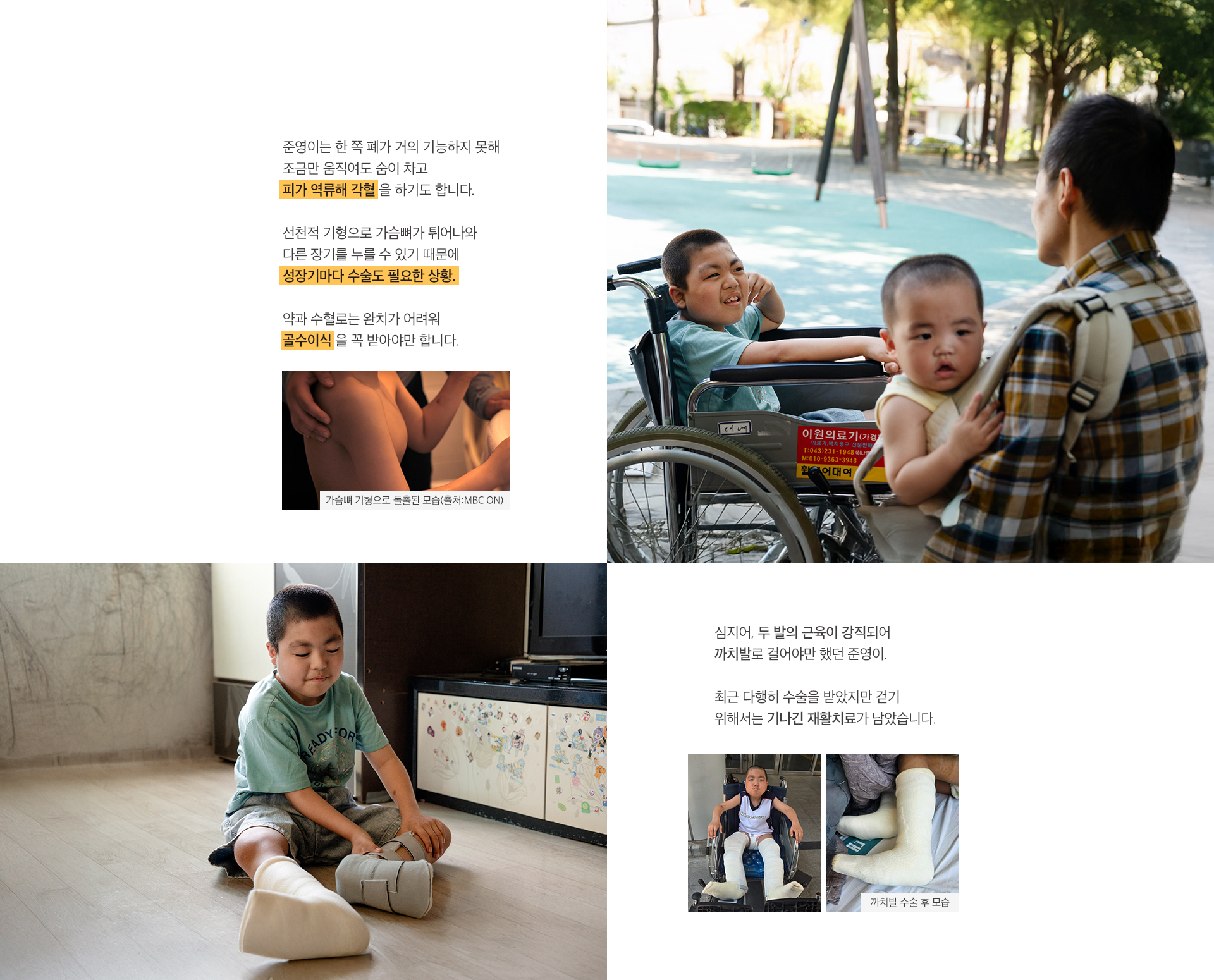 스테로이드 약, 골수 이식… 벅찬 치료들